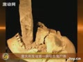 ����ѧ���ڷ�Ĺ���״η���Ů��Ѫ��ʬ��